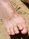 Bunion Removal | Bayside NY